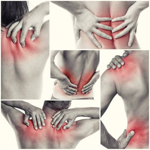 Muscle Strain